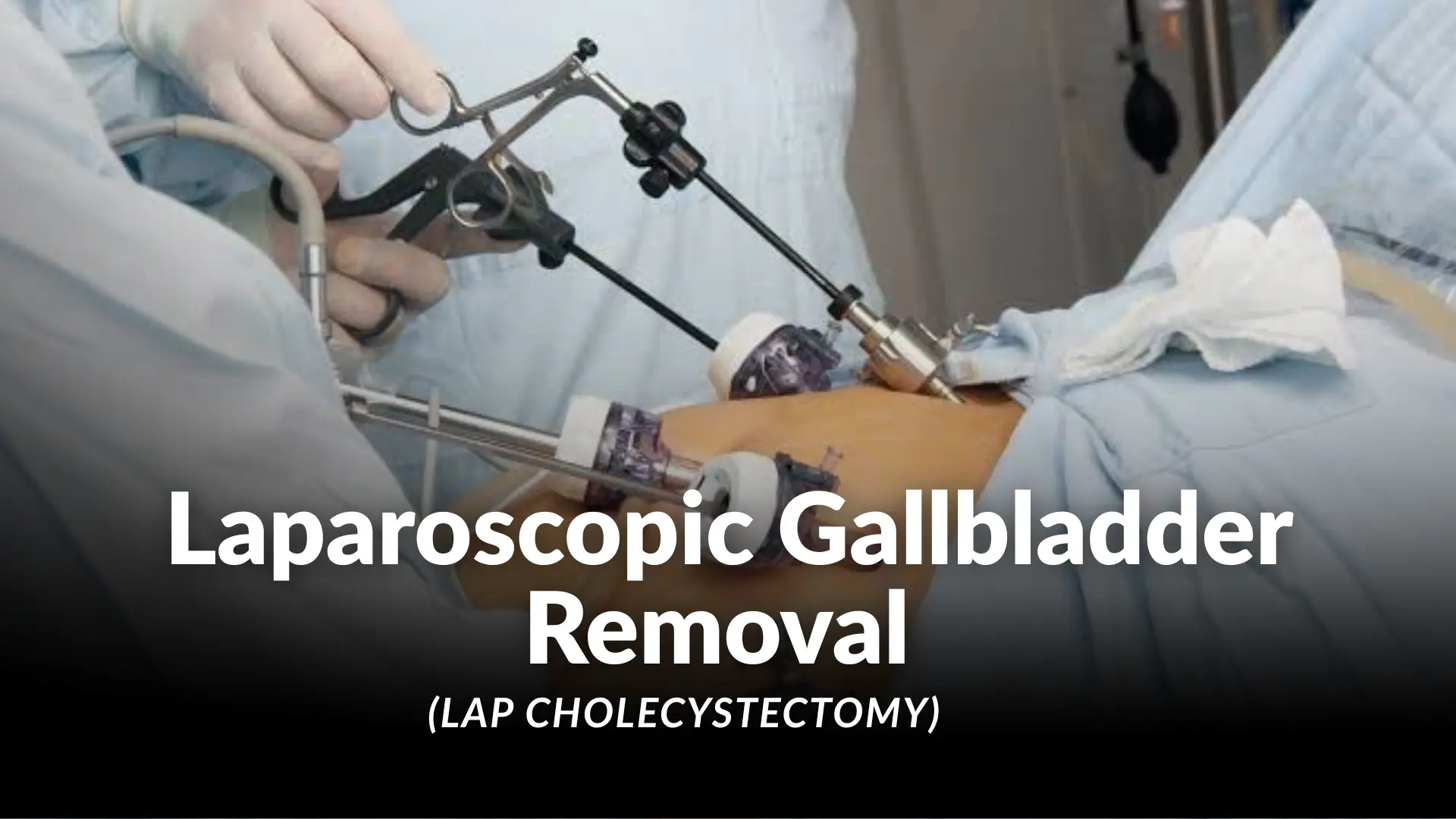 Lap Cholecystectomy
